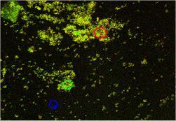 Laser scanning microscope image of protein amyloids stained with novel LCP fluorescent probes. Image: Mikael Lindgren