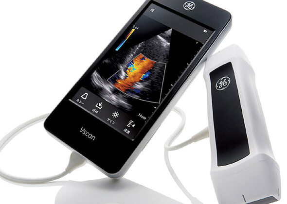 vscan handheld ultrasound device