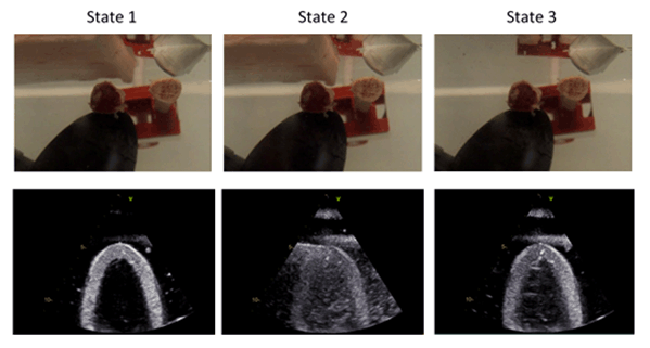 Watertank experiment - ultrasound with rib bones and fat.