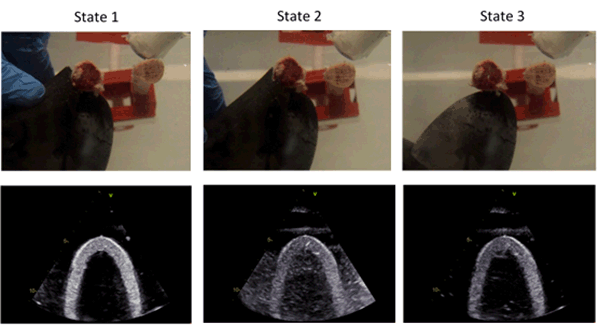 Watertank experiment - ultrasound with rib bones and sponge.