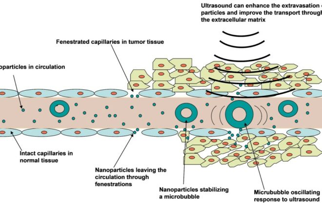 Illustration of ultrasound mediated chemotherapy.
