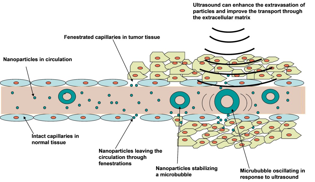 Illustration of ultrasound mediated chemotherapy.