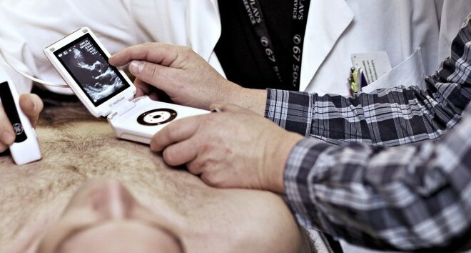 Handheld ultrasound apparatus in use.