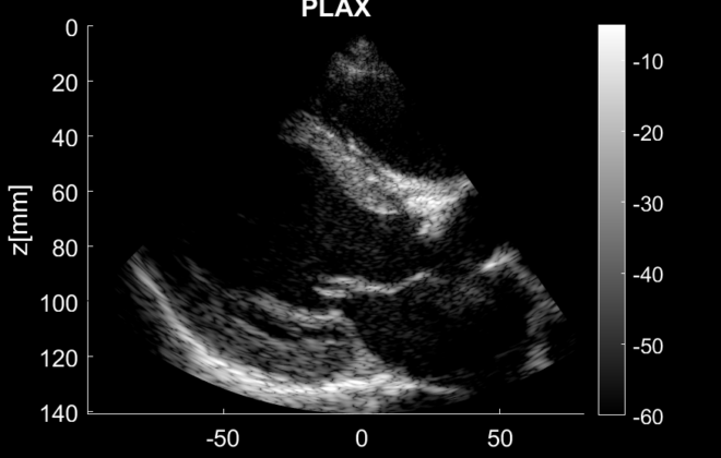 Ultrasound image of the heart