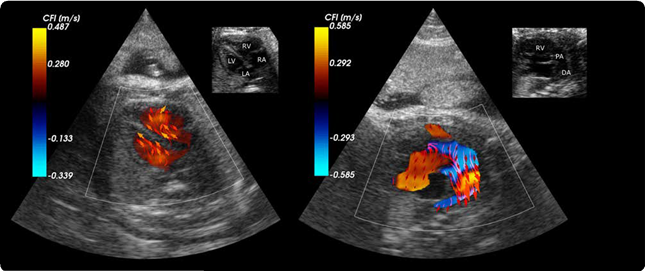 Ultrasound scans of foetal heart.