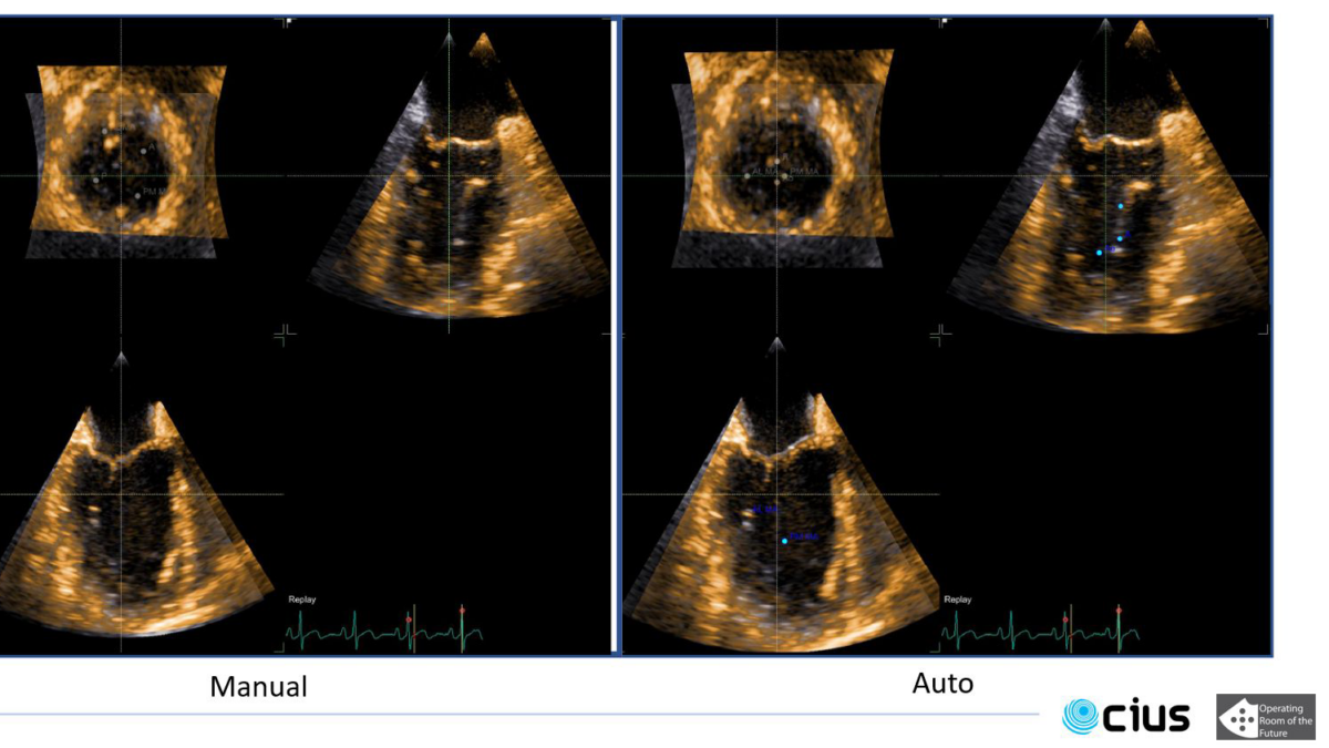 Series of ultrasound images of the heart.
