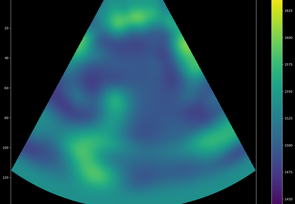Ultrasound speed map with blue and green indicating speed.
