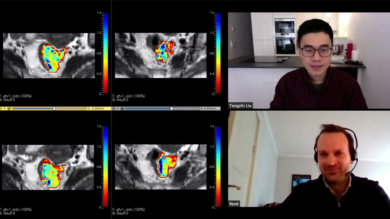 To deltakere i forskningsgruppen diskuterer på skjerm med fire røntgenbilder ved siden av de. Foto