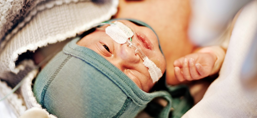 newborn with oxygen probe