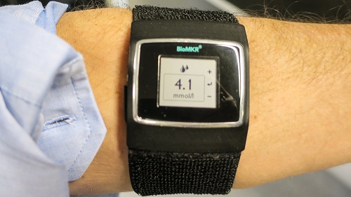 Armbånd for diabetikere: Med den nye norske multisensoren kan diabetikere få glukoseverdien rett på armen uten å stikke seg. (Foto: orv)