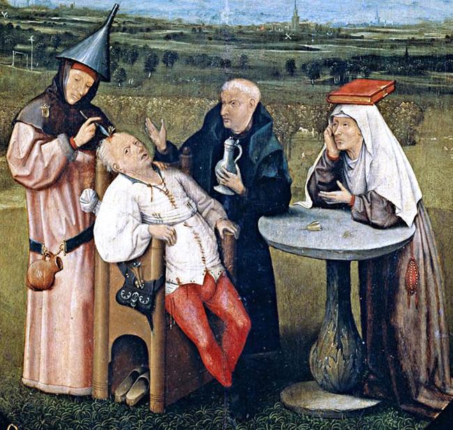 Maleri av trepanering: Mann sitter i en stol, mens en mann står over ham og lager hull i skallen. En munk og en nonne ved siden av.