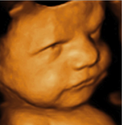3D-bilde av foster